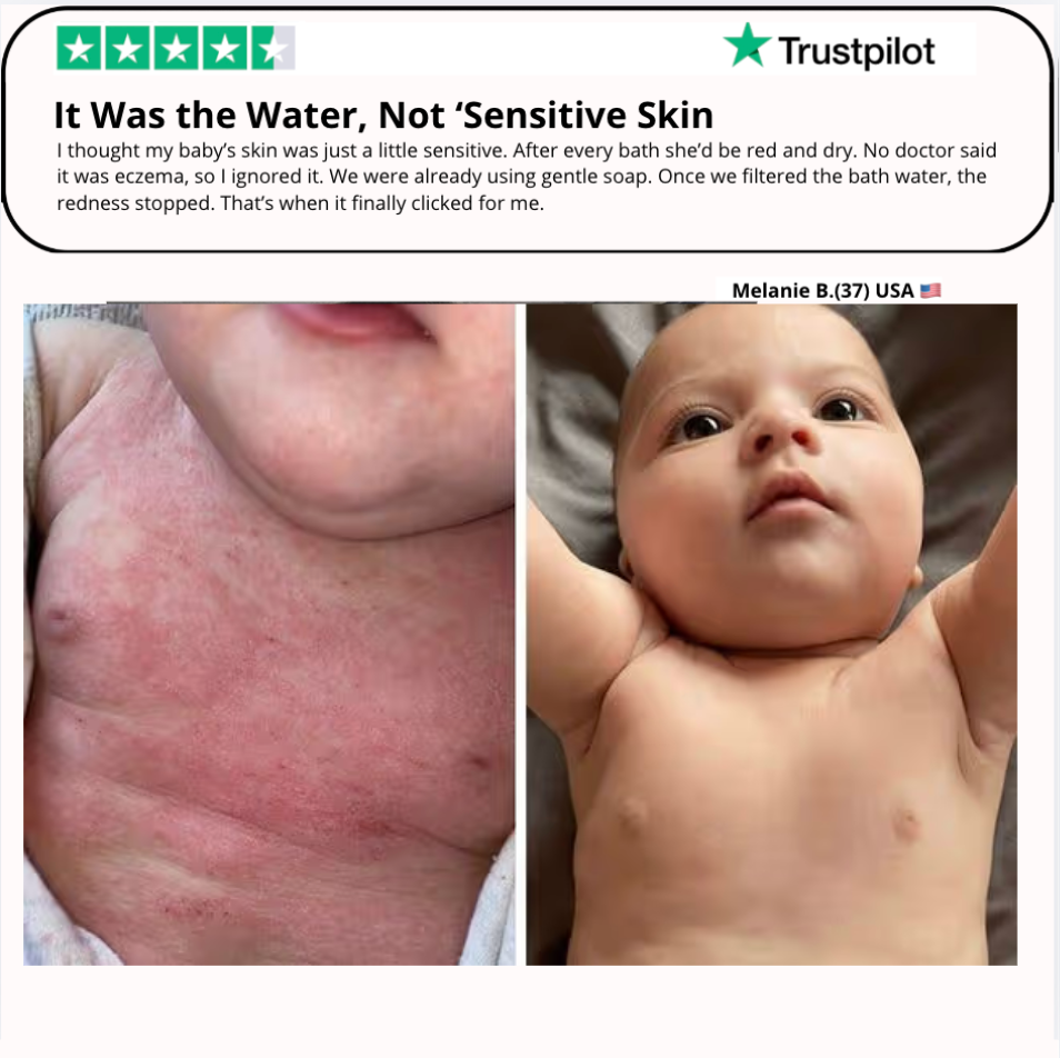 Artivex+ Bath filter (Symptom-But-Not-Diagnosed Parent)