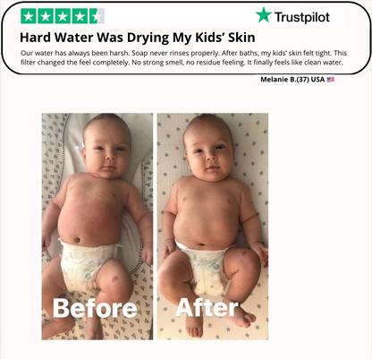 Artivex+ Bath filter (Hard-Water Survival Parent)