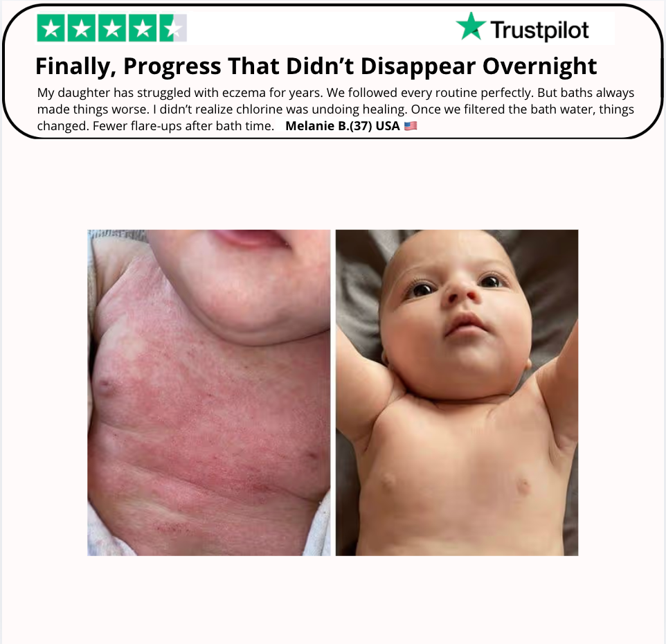 Artivex+ Bath filter (Chronic Eczema Mom)