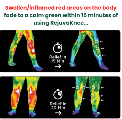 Artivex+ knee massager